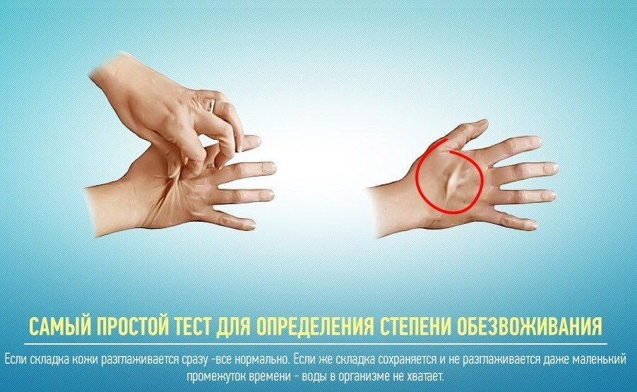 Обезвоживание организма